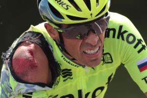 Spain’s Alberto Contador, injured after a crash, rides during the 188 km first stage of the 103rd edition of the Tour de France cycling race on July 2 between Mont-Saint-Michel and Utah Beach Sainte-Marie-du-Mont, Normandy 